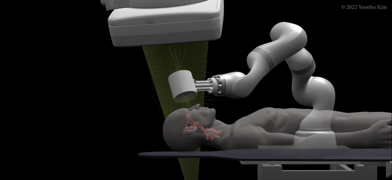 Forradalmi egészségügyi technológia: sebészrobot operálja a stroke-betegeket